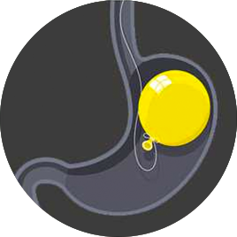 Gastric Balloon